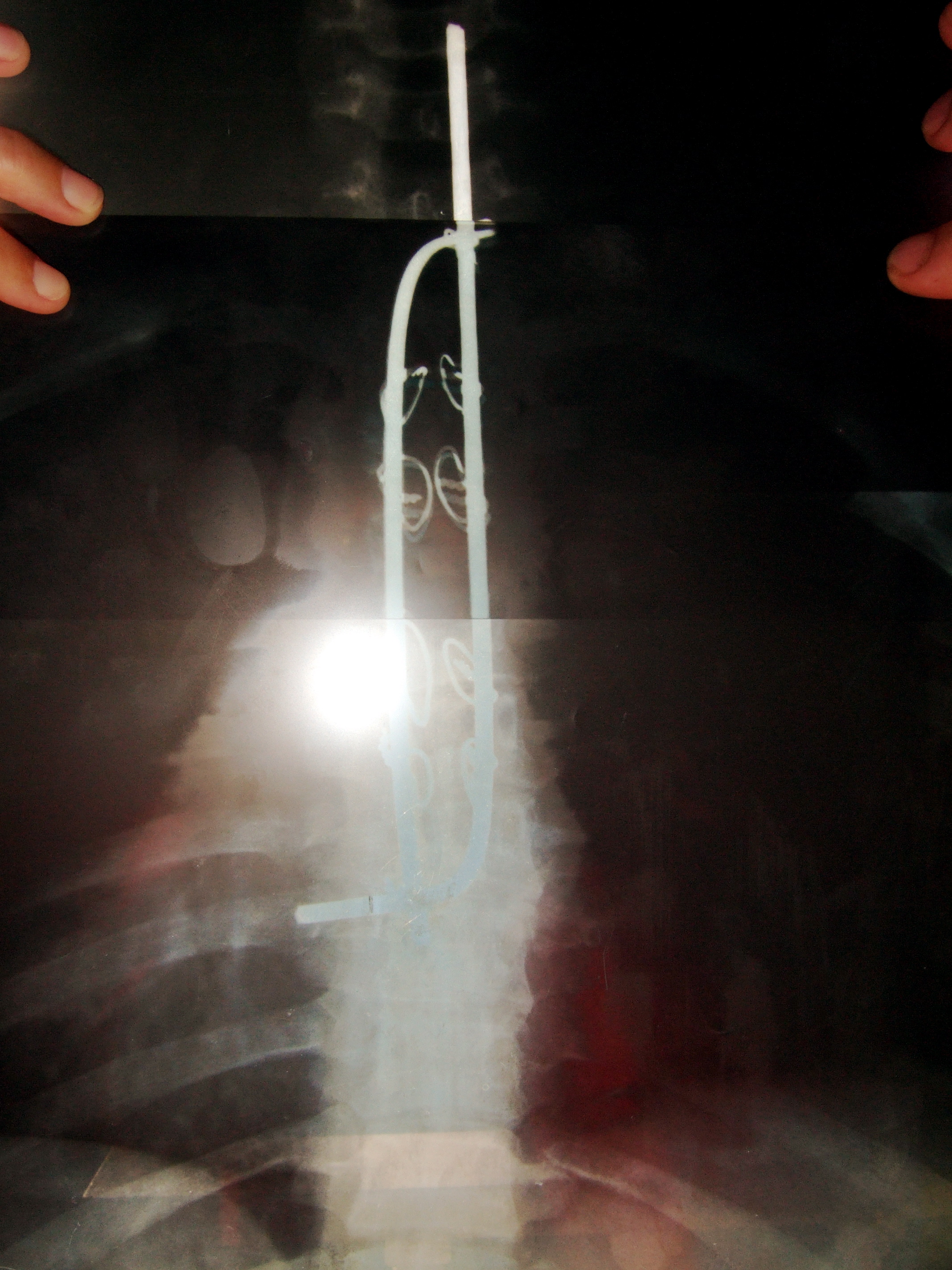 Xray1