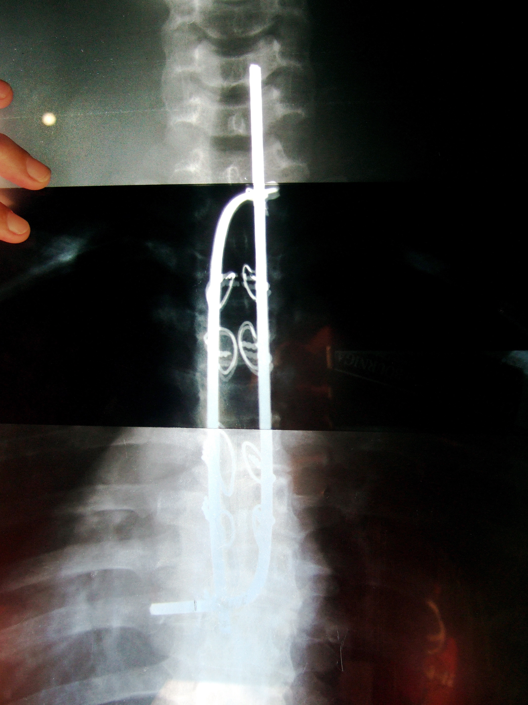 xray3